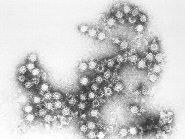 Photo: Enterovirus 68