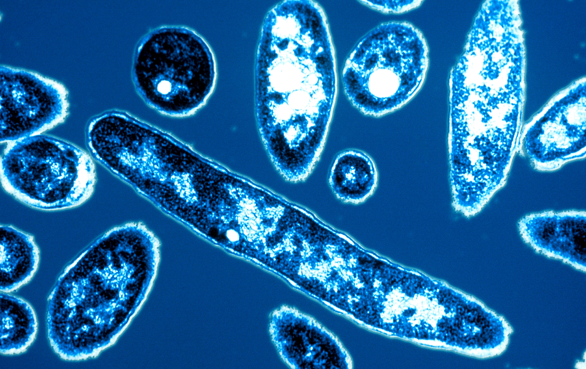 legionnaires-disease