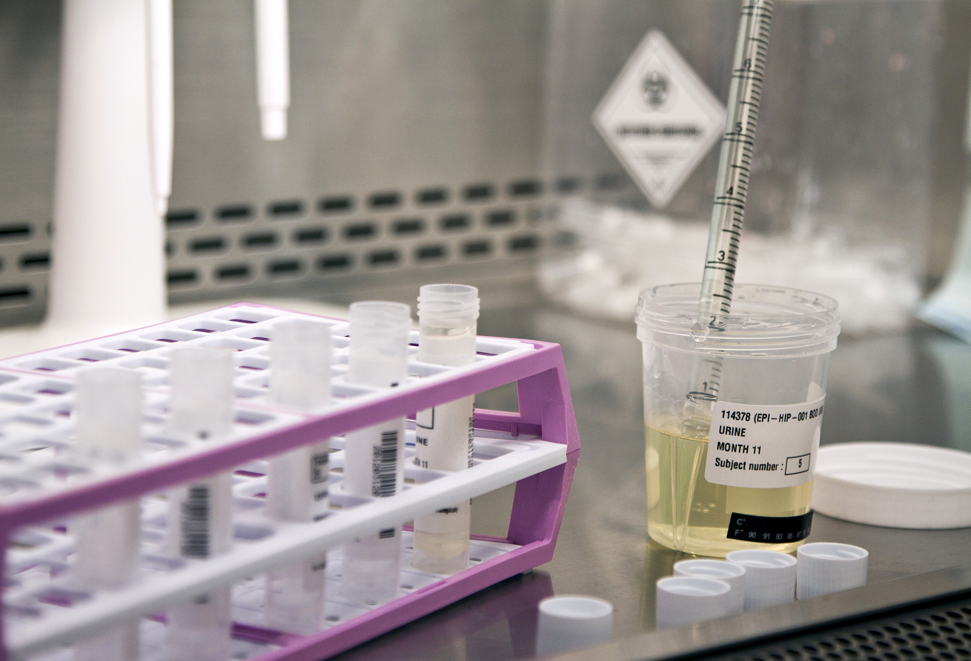 urine-test-1