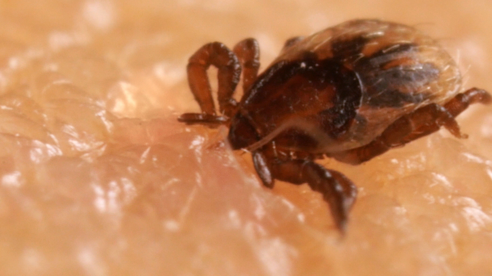 dl_505tickbite_tick_nymph_attached_to_human_skin_profile_1920_2