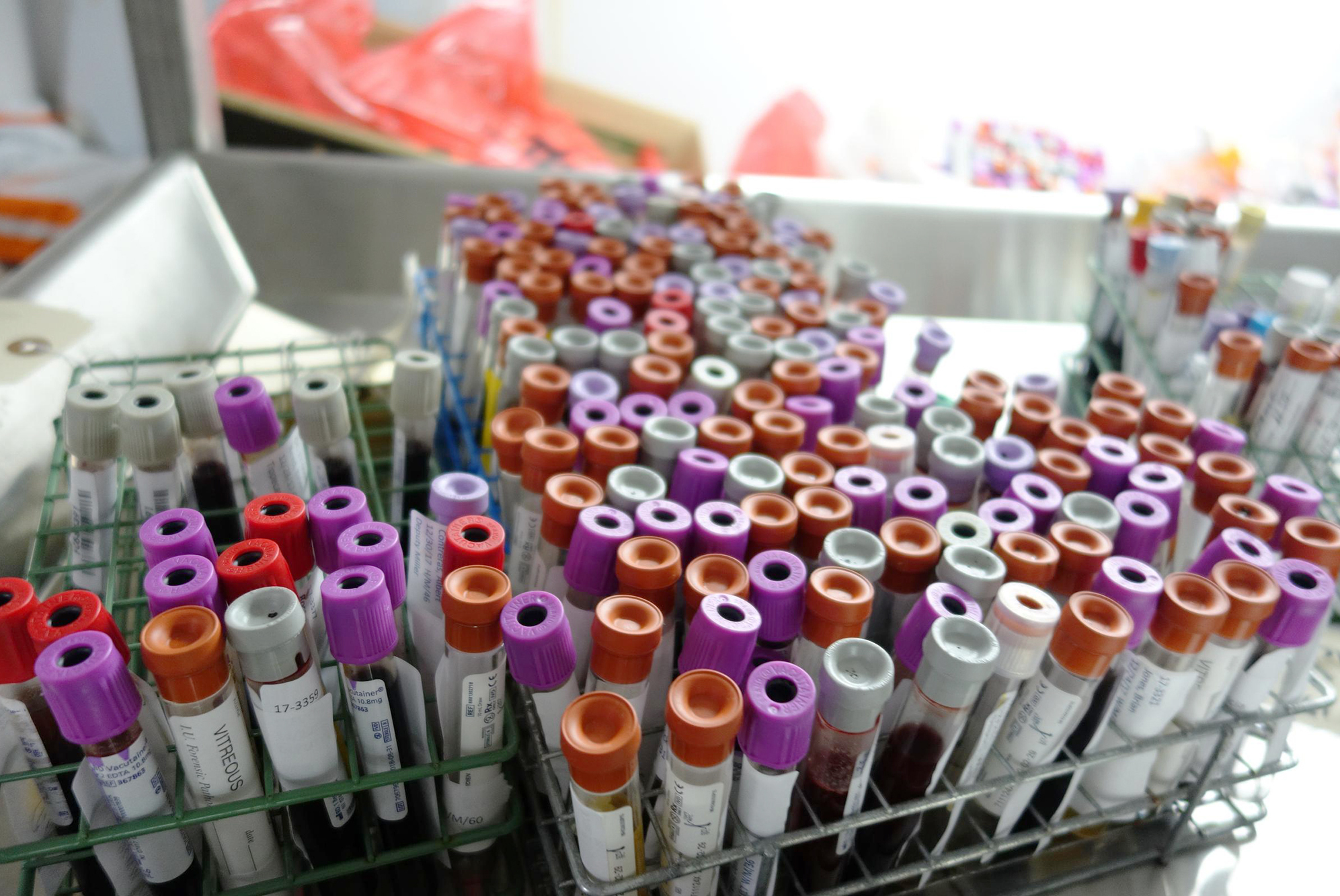 vials-blood-1