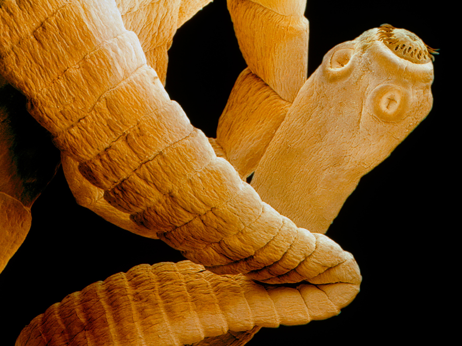 tapeworm