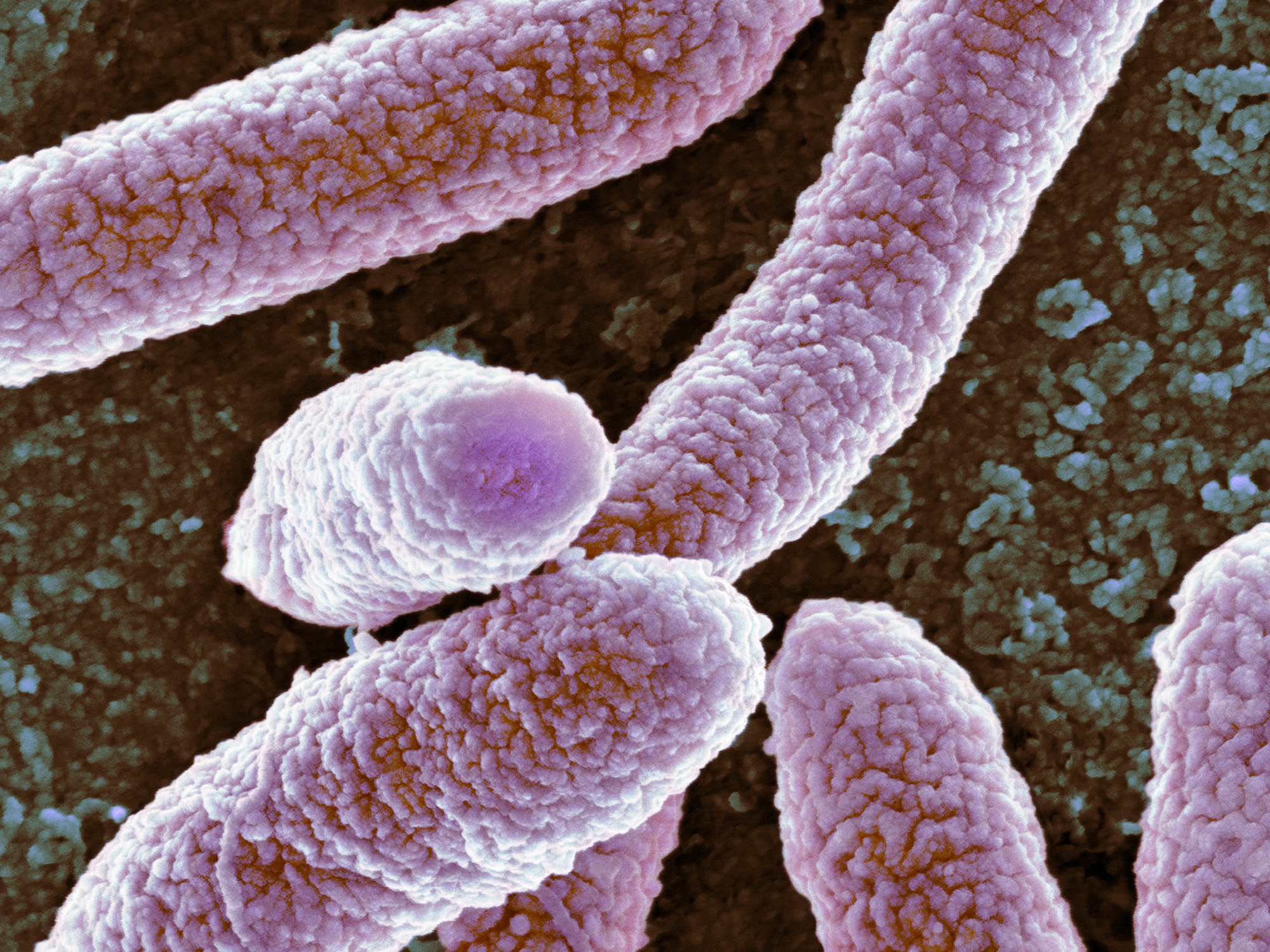 e-coli-01
