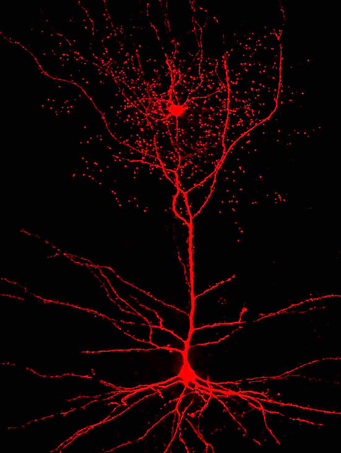 rosehip-and-pyramidal-neuron