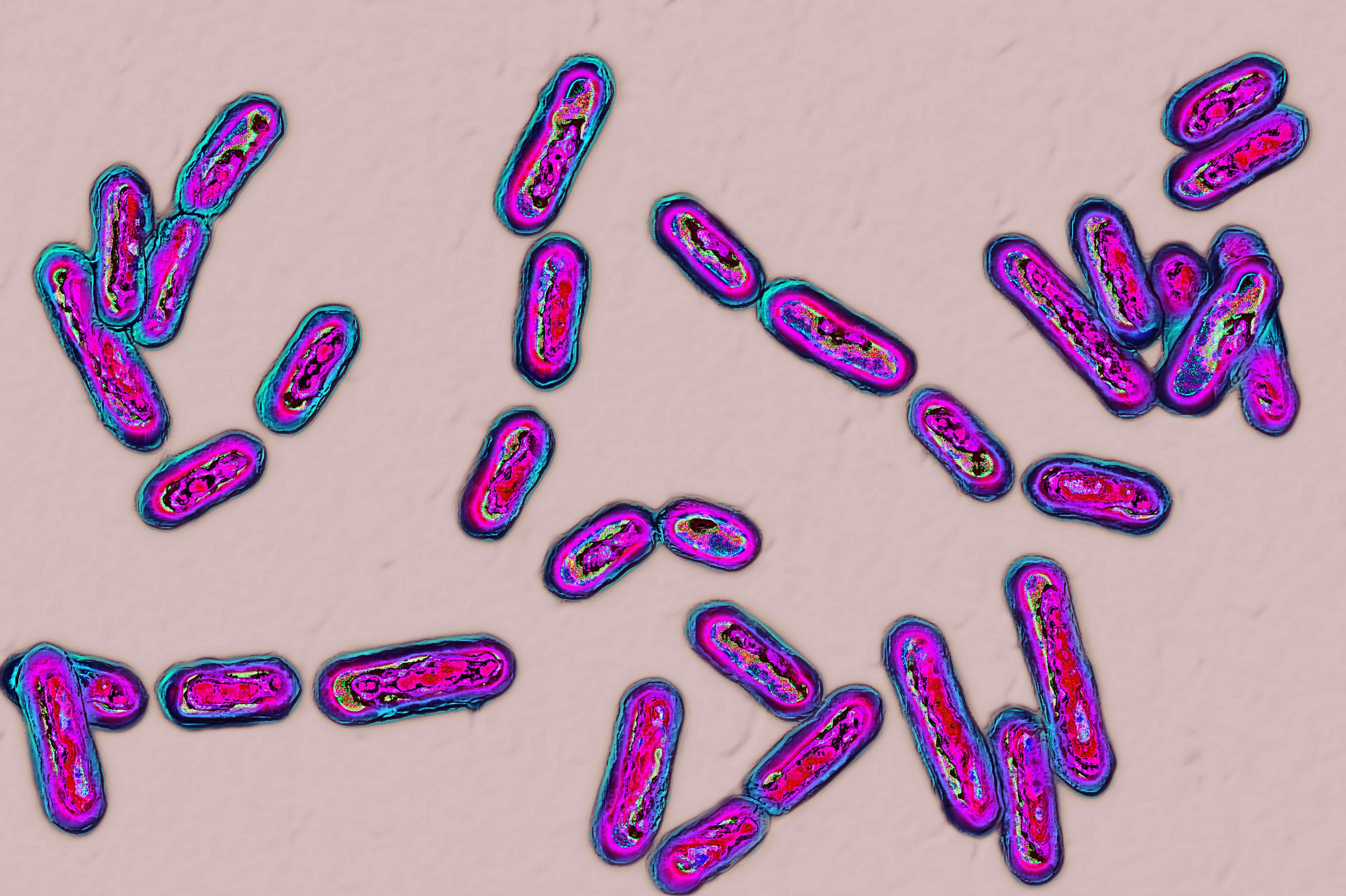c-diff