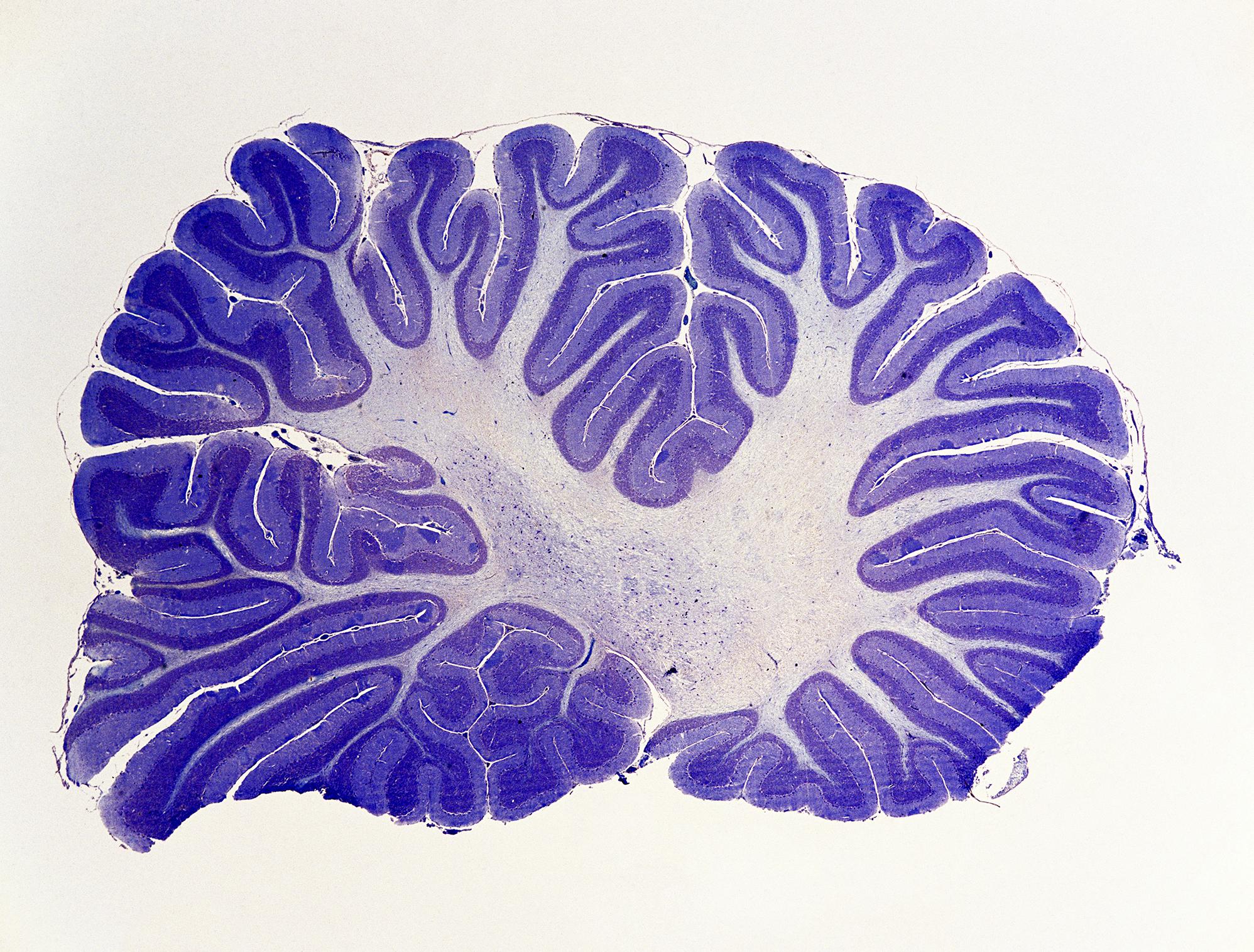cerebellum