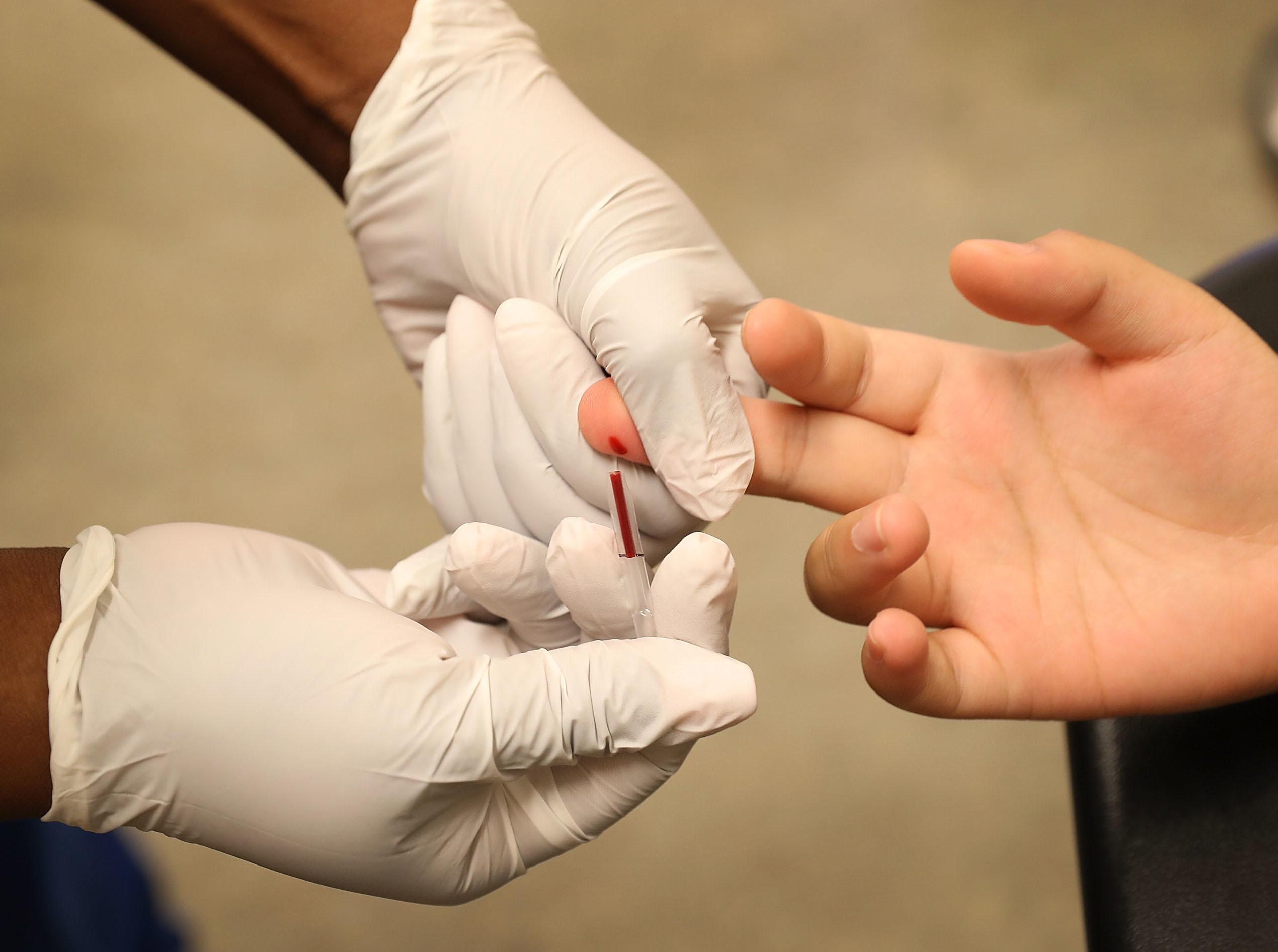 sotu-hiv-1