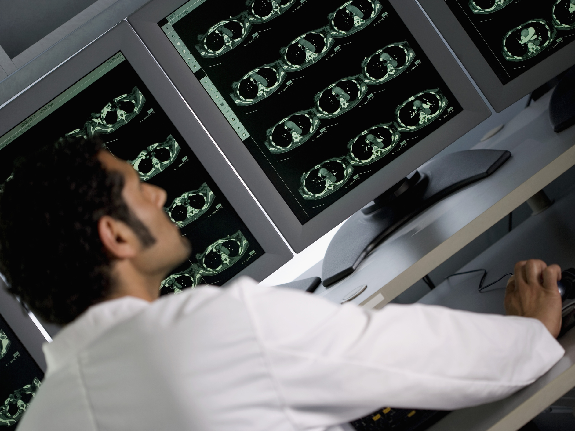 mri-image