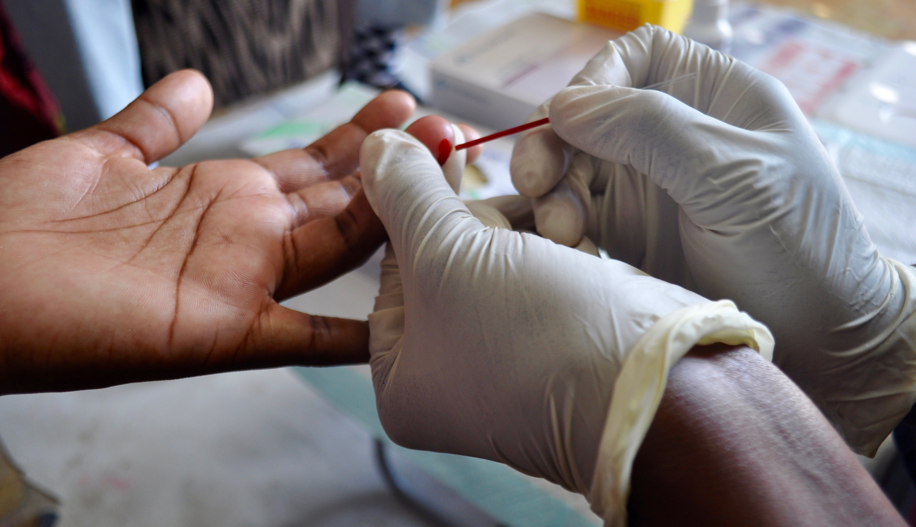 popart-blood-test-close-up-ikhwezi