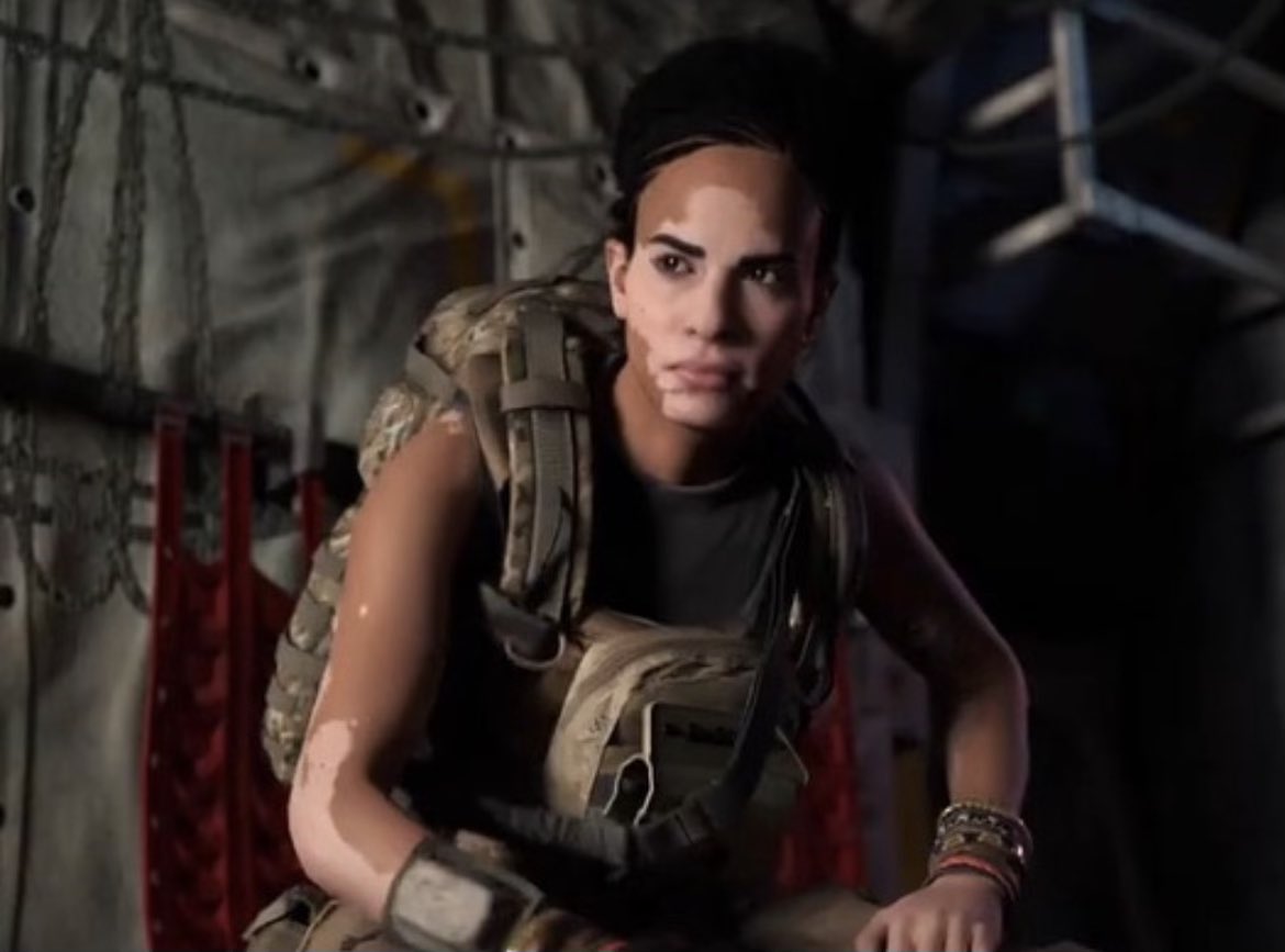 Jasmine Colgan Call Duty Modern Warfare Vitiligo